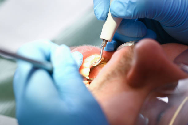 Best Weekend Emergency Dental Services in Splendora, TX